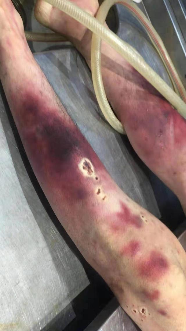邢燕军“指居”期间死亡案撤销调查，